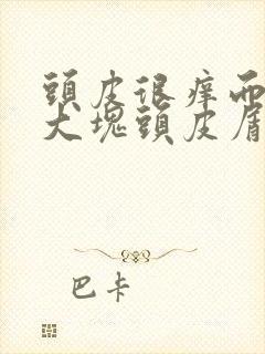 头皮很痒而且有大块头皮屑怎么回事