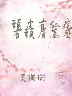 头皮有红疙瘩还有头屑怎么办