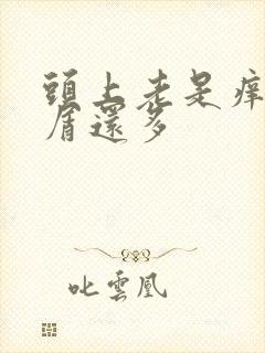 头上老是痒头皮屑还多