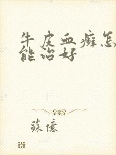 牛皮血癣怎么才能治好