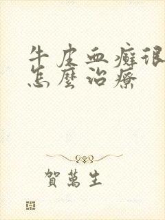 牛皮血癣很严重怎么治疗