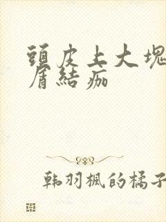 头皮上大块头皮屑结痂