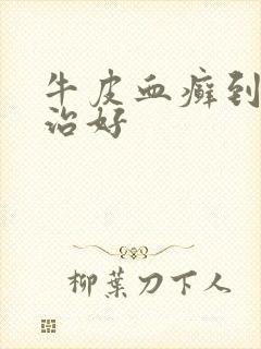 牛皮血癣到哪里治好