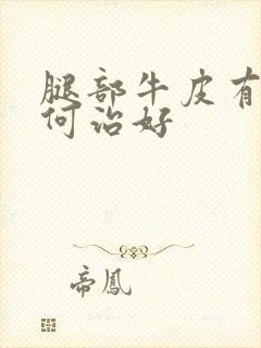 腿部牛皮有癣如何治好