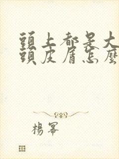 头上都是大块干头皮屑怎么治