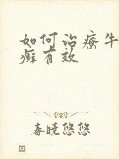 如何治疗牛皮有癣有效