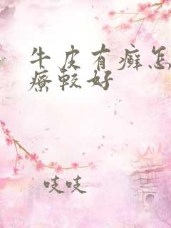 牛皮有癣怎么治疗较好