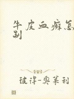 牛皮血癣怎么抑制