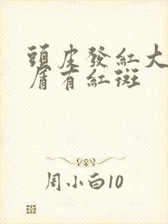 头皮发红大块头屑有红斑