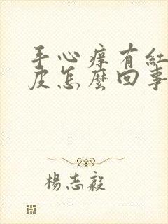 手心痒有红点脱皮怎么回事