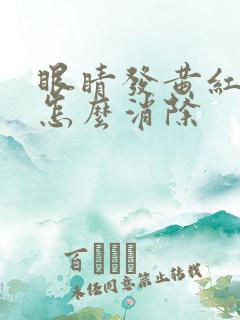 眼睛发黄红血丝怎么消除