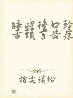 睡醒后口干口苦舌头有齿痕