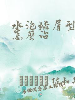 水泡鳞屑型手癣怎么治