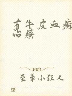 有牛皮血癣怎么治疗