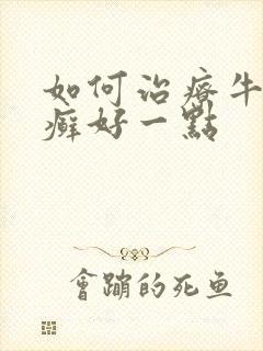 如何治疗牛皮有癣好一点