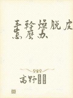 手干燥脱皮开裂怎么办