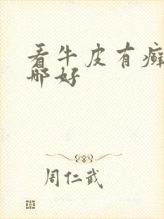 看牛皮有癣医院哪好