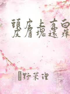 头皮上有白色的皮屑块还痒是怎么回事