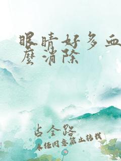 眼睛好多血丝怎么消除