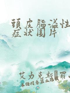 头皮脂溢性掉发症状图片