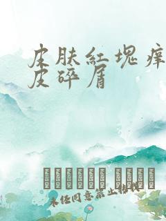 皮肤红块痒干脱皮碎屑