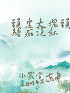 头皮大块头皮屑结痂泛红