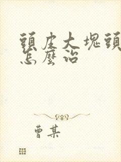 头皮大块头皮屑怎么治