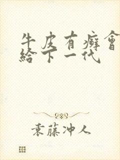 牛皮有癣会遗传给下一代