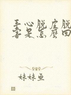 手心脱皮脱得厉害是怎么回事