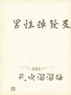 男性掉发及治疗