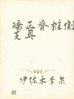 矫正脊椎侧弯的支具