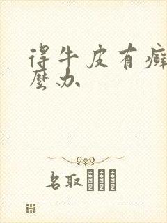 得牛皮有癣了怎么办