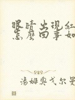 眼睛出现红血丝怎么回事如何缓解