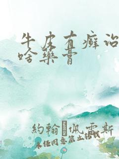 牛皮有癣治疗用啥药膏