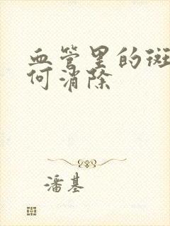 血管里的斑块如何消除