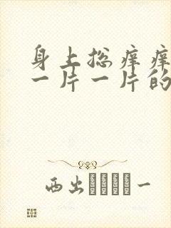 身上总痒痒一挠一片一片的疙瘩是怎么回事