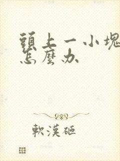 头上一小块掉发怎么办