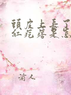 头皮上长了很多红疙瘩是怎么回事