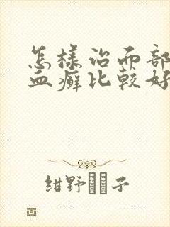 怎样治面部牛皮血癣比较好