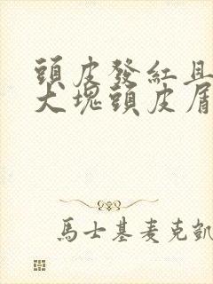 头皮发红且伴有大块头皮屑