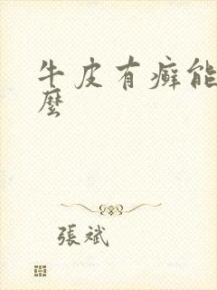 牛皮有癣能治疗么