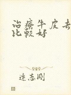 治疗牛皮去哪里比较好