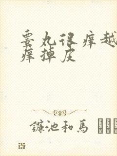 睾丸很痒越抓越痒掉皮