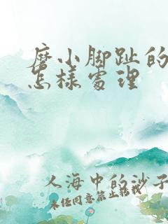 磨小脚趾的鞋子怎样处理