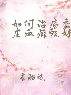 如何治疗季节牛皮血癣较好