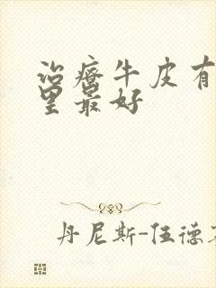 治疗牛皮有癣哪里最好