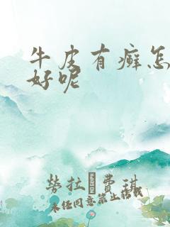 牛皮有癣怎么治好呢