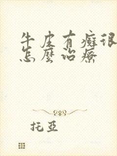 牛皮有癣很严重怎么治疗