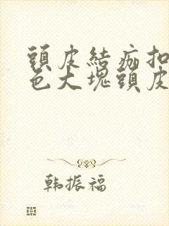 头皮结痂扣下白色大块头皮屑