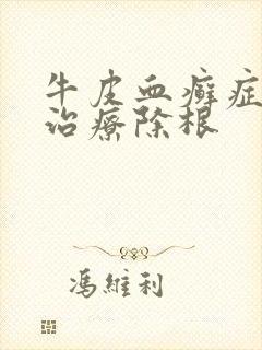 牛皮血癣症怎么治疗除根